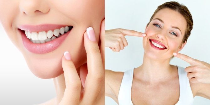 Cara ampuh membuat Gigi putih berseri