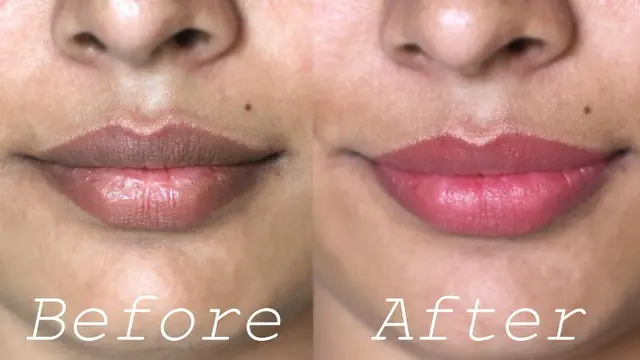 6 Cara Mengatasi Bibir Hitam Secara Alami dan Membuatnya Tampak Merah Merona!